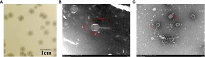 Isolation and Characterization of vB_kpnM_17-11, a Novel Phage Efficient Against Carbapenem-Resistant Klebsiella pneumoniae